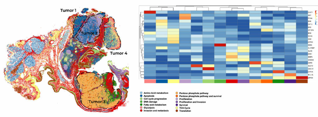 Tumors